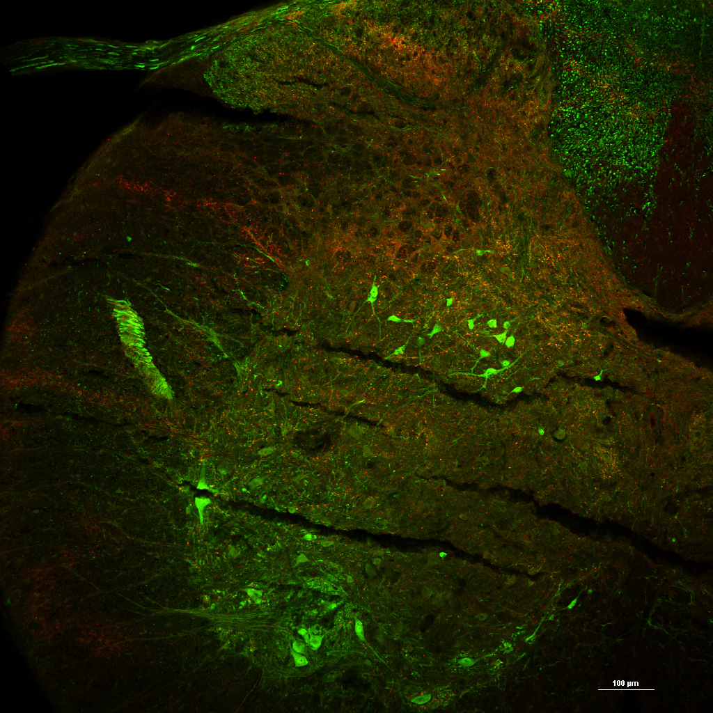 dI3 Ins in cervical segment